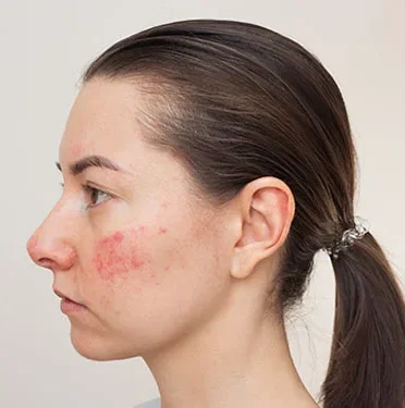 Best Dermatologist in Lucknow