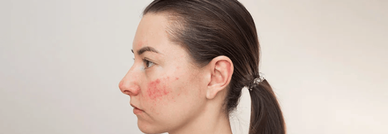 Best Dermatologist in Lucknow