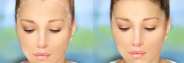 Hair Transplant Cost in Saudi Arabia 2026
